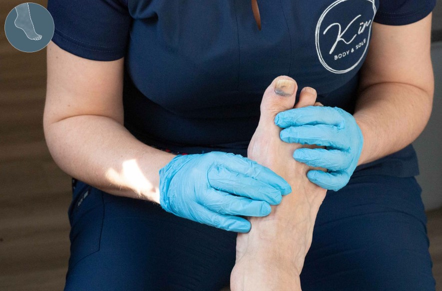 Conditions Chiropodists Treat